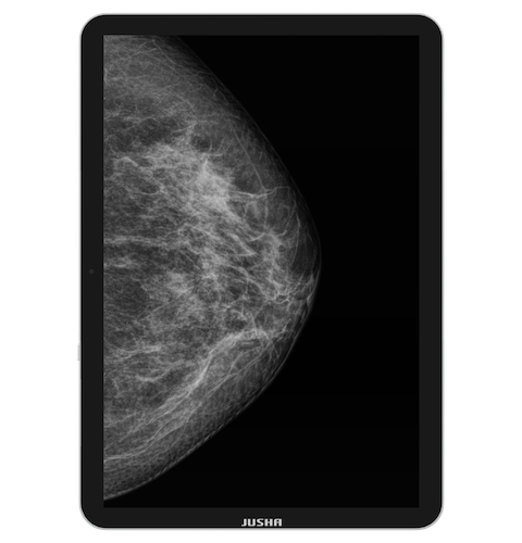 CP620 6MP/Color/Diagnostic portable tablet