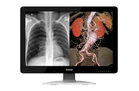 JUSHA 660G 6MP Diagnostic Display