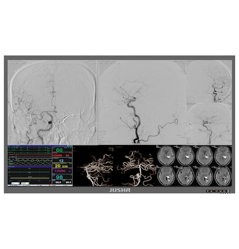JUSHA S5180 58" 8MP Integrated surgery fusion display system