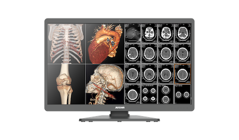 JUSHA C820G 32" 8MP Diagnostic Display