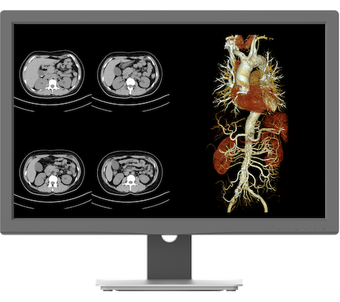 JUSHA C240G 2MP Diagnostic Display