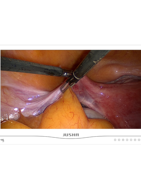 JUSHA E240AG 23.8" FHD Surgical Display