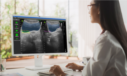 This allows the device to run various AI-powered apps for diagnostics, patient monitoring, and more , seamlessly supporting diverse healthcare needs.